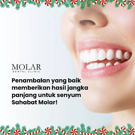 Aesthetic Tooth filling / Penambalan gigi